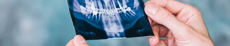 Рентген зубов в Чертаново